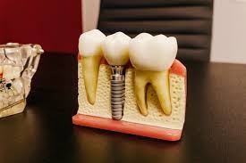 When choosing a private dentist, consider the following factors When choosing a private dentist, consider the following factors